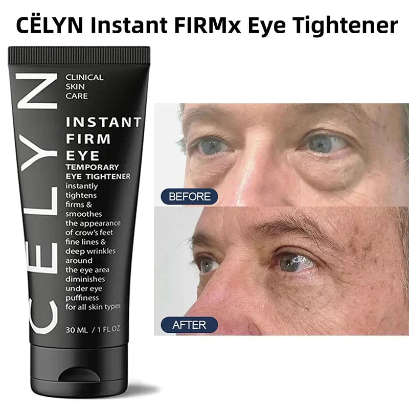 Celyn Eye Instant Care