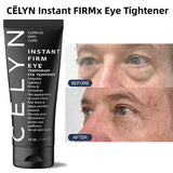 Celyn Eye Instant Care